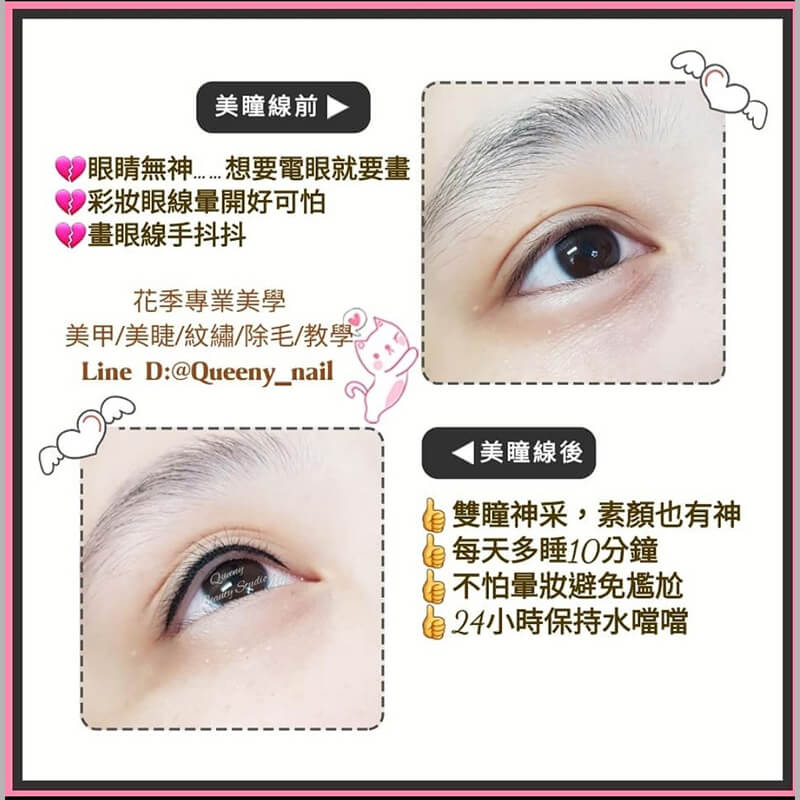 美瞳線