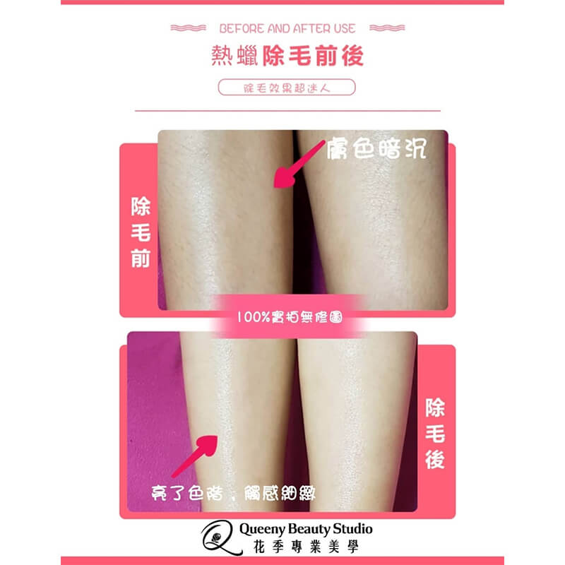 熱蠟除毛
